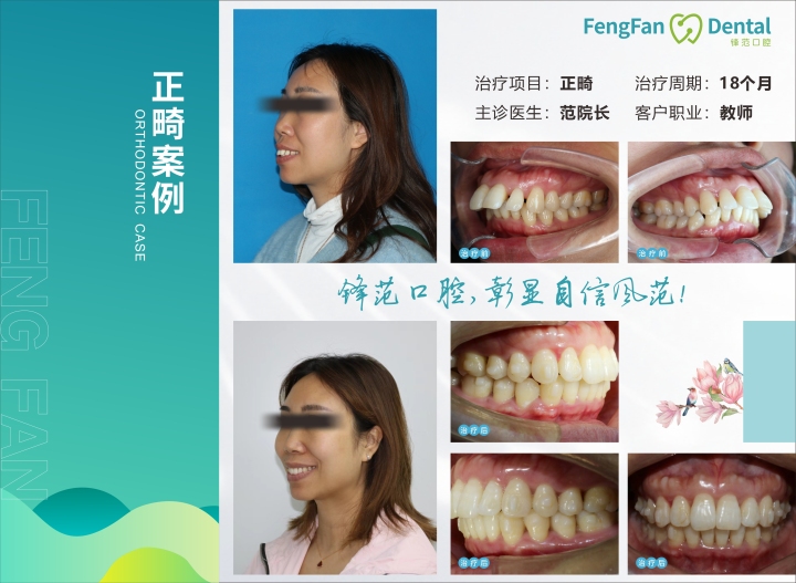 专业团队进行方案研讨