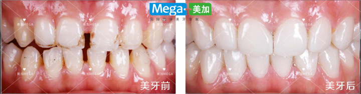 先进美牙设备与标准化治疗室