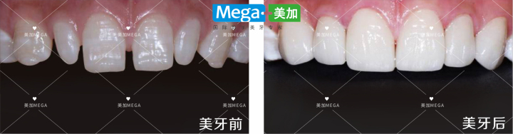 国际化美牙材料与技术合作