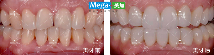 国际化美牙材料与技术合作