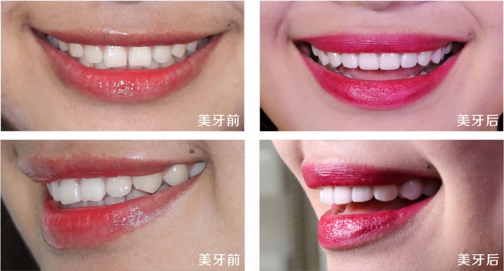 锋范口腔美学修复环境展示