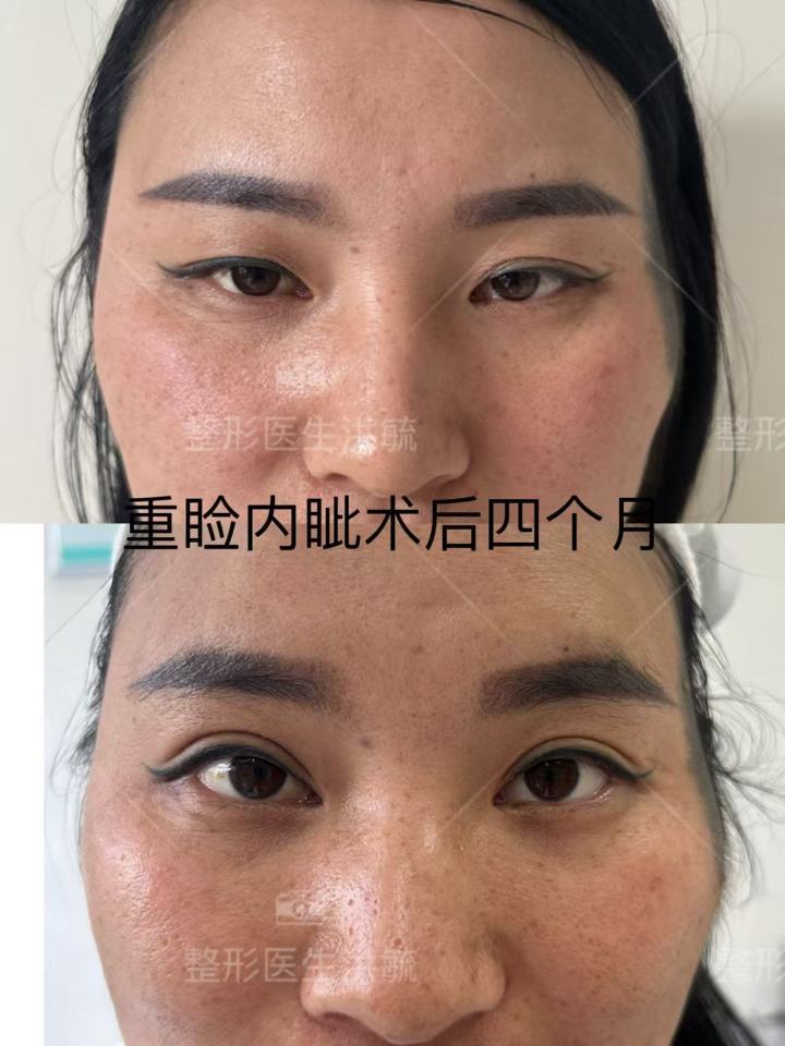 私密整形与精细修复环境示意