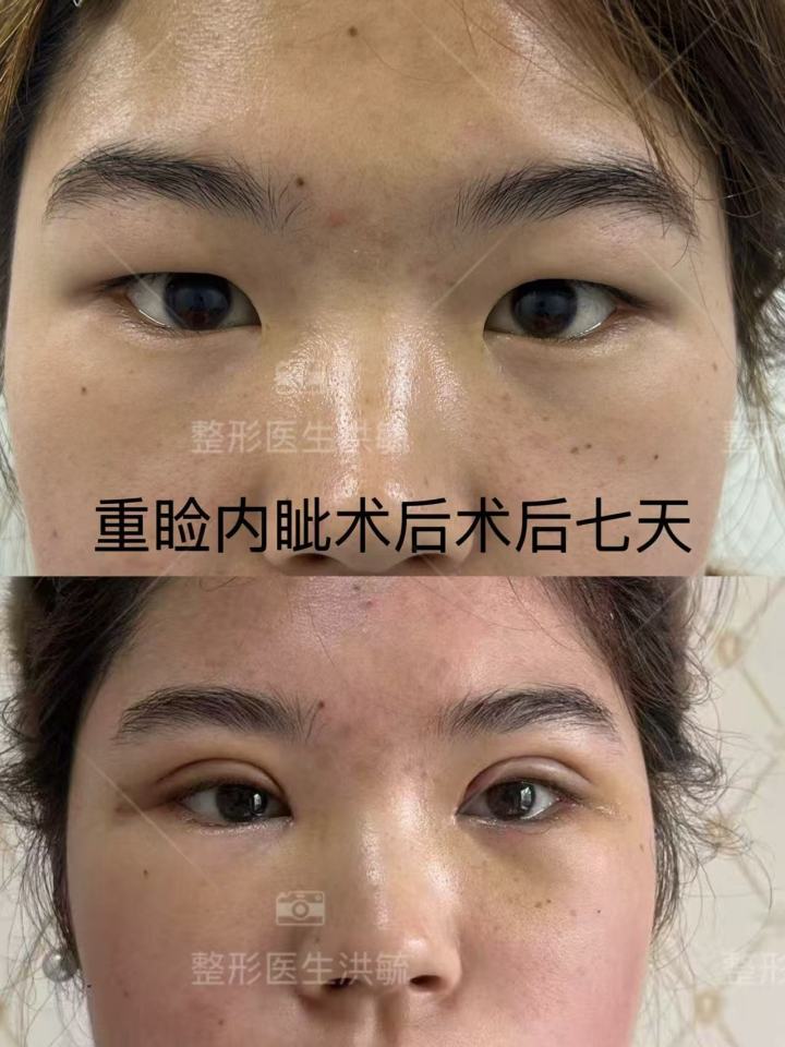 眼部修复医师推荐