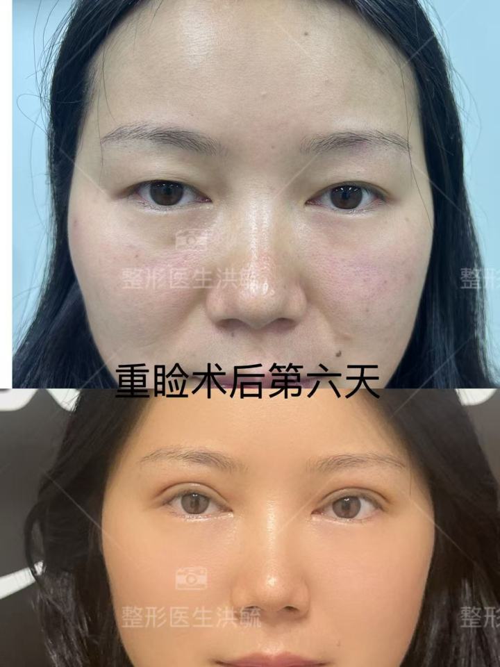 浙江提眉塑形外科医生哪个专业