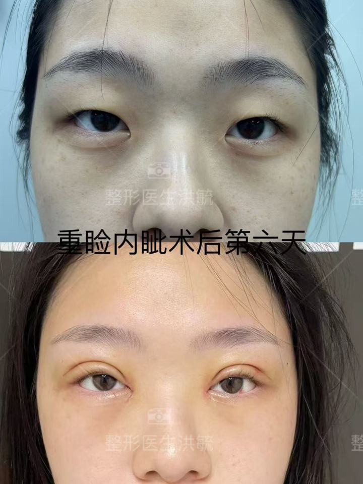 眼部精雕效果展示