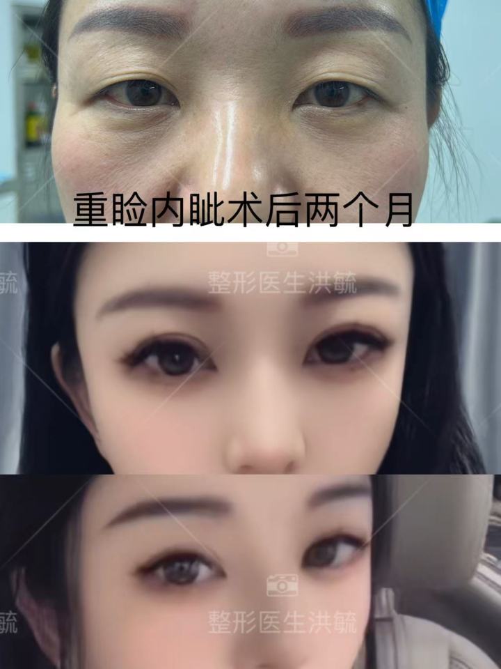 眼部修复医师推荐