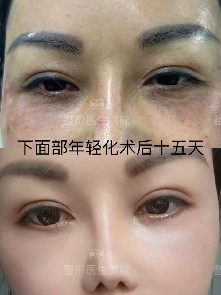 精细化手术技术示意