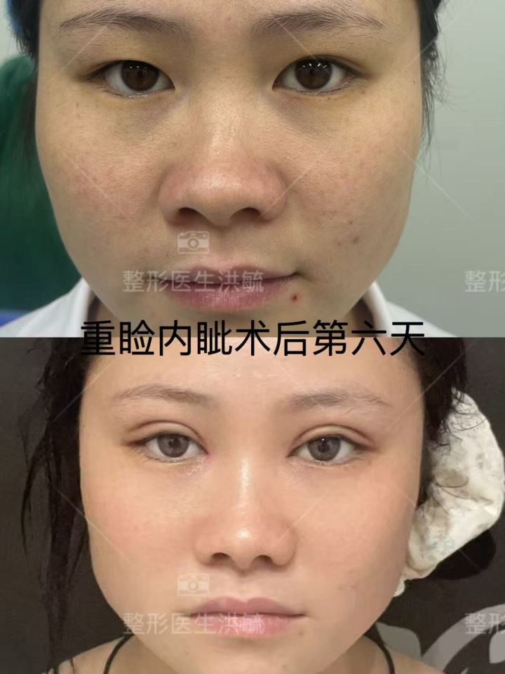 个性化方案设计过程