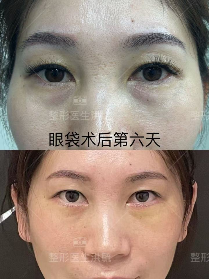 永康光大术后护理病房展示