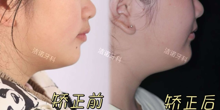 罗江儿童口腔预防老牌机构找哪个