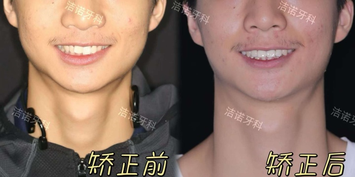 德阳旌阳区洁诺牙科诊所：深耕口腔预防，广汉口碑品牌医院推荐与信誉解析